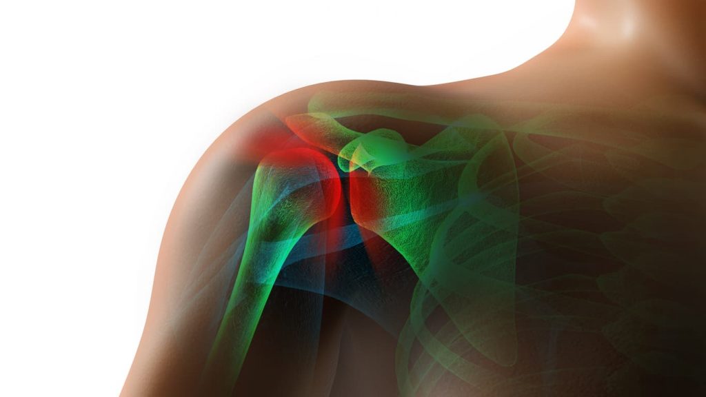 can a car accident cause a torn rotator cuff
